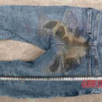 Examination and autopsy of Chinese woman
