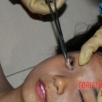 Examination and autopsy of Chinese woman