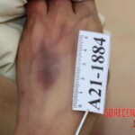 Examination and autopsy of Chinese woman