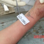 Examination and autopsy of Chinese woman