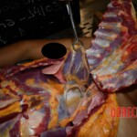 Examination and autopsy of murdered teenager