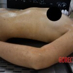 Examination and autopsy of murdered teenager