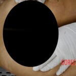 Examination and autopsy of murdered teenager