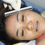 Examination of dead Chinese woman