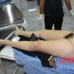 Examination of dead Chinese woman