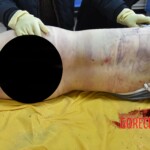 Initial examination of dead Chinese teenager