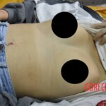 Initial examination of dead Chinese teenager