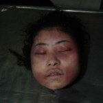 Dead female