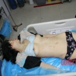 Dead female