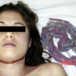 Dead female