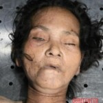 Dead female