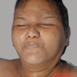 Dead female