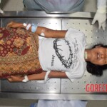 Dead female