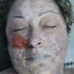 Dead female