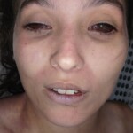 Dead female
