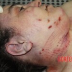 Dead female