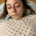 Dead female