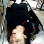 Dead female