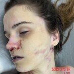 Dead female