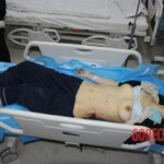 Dead female