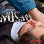 Victims of Israeli-American air attacks on Iran