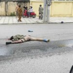 Biker suffered devastating head injuries in collision with dump truck