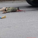 Biker suffered devastating head injuries in collision with dump truck