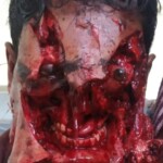 Face severely disfigured after bear attack
