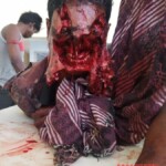 Face severely disfigured after bear attack