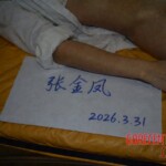 Female hotel employee died of heart failure