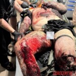Heavily injured Ukrainian soldier receiving treatment in field hospital