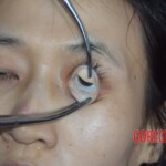Initial examination of hanged Chinese woman #4