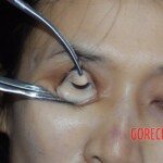 Initial examination of hanged Chinese woman #4