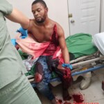 Seriously injured in machete attack