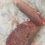 Seriously injured in machete attack