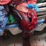 Seriously injured in machete attack