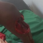 Seriously injured in machete attack