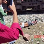 Train took both of his legs