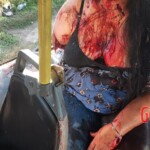Two women killed and 25 injured in bus-truck collision
