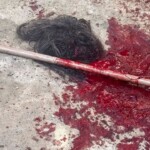 Woman brutally attacked by her own dog