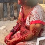 Woman brutally attacked by her own dog
