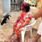 Woman brutally attacked by her own dog