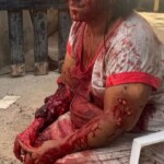 Woman brutally attacked by her own dog