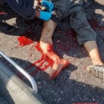 Elderly man struck by vehicle in hit-and-run accident