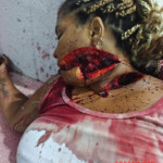Man murders ex-girlfriend with machete, commits suicide two days later