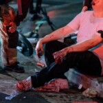 Man's hand severely mangled in fireworks accident