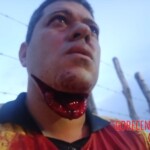 Mototaxi driver got his throat slit during robbery