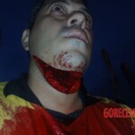 Mototaxi driver got his throat slit during robbery