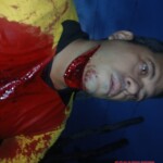 Mototaxi driver got his throat slit during robbery