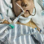 14-year-old girl survived fall from fourth floor